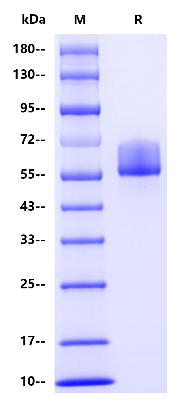 Human Haptoglobin, His tag
