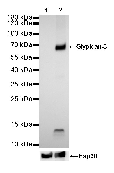 Glypican-3 Recombinant Rabbit mAb (SDT-R032)