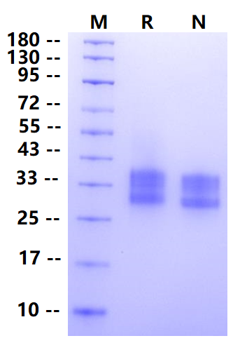 Biotinylated CD7 His&Avi Tag Protein, Human