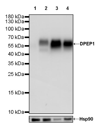 DPEP1 Recombinant Rabbit mAb (S-R293)