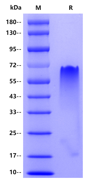 Human TSH alpha/beta Heterodimer, His tag