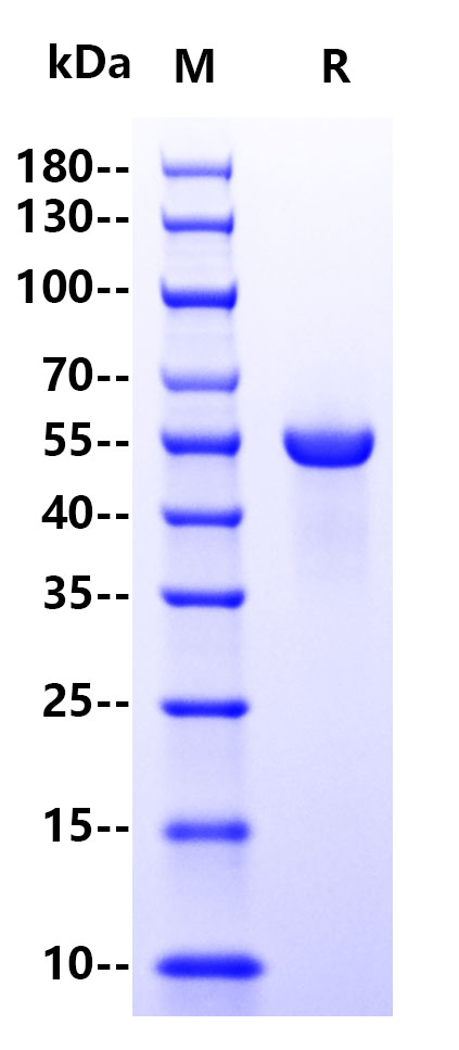 Human Laminin gamma 1, His Tag