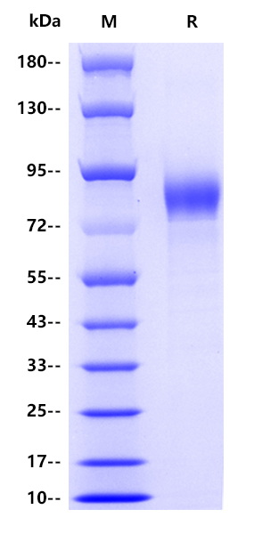 Influenza A virus H3N2-HA（A/canine/Guangdong/1/2006  H3N2）, His tag