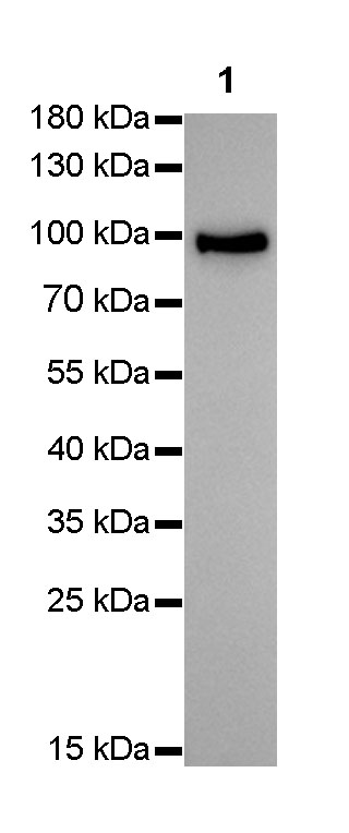 S-RMab® Villin Recombinant Rabbit mAb(SDT-039-78)