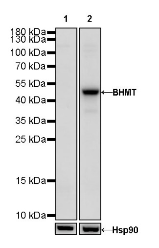 BHMT Recombinant Rabbit mAb (S-R286)