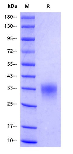 Mouse CD8A Protein, His tag