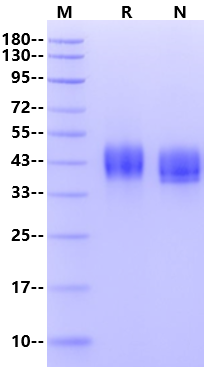 MXRA8/DICAM His Tag Protein, Mouse