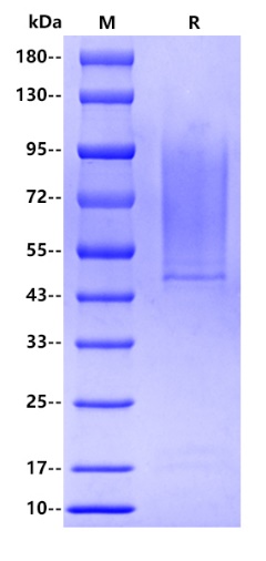 Mouse CD43 Protein, His tag