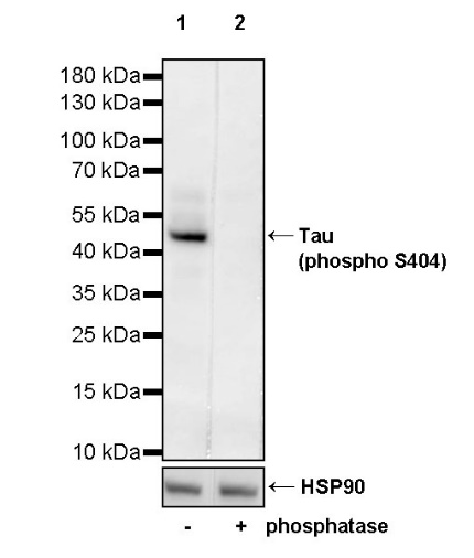 Tau (phospho S404) Recombinant Rabbit mAb (S-982-20)