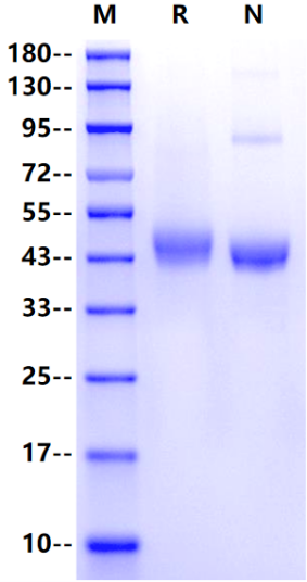 SFTPD His Tag Protein, Mouse