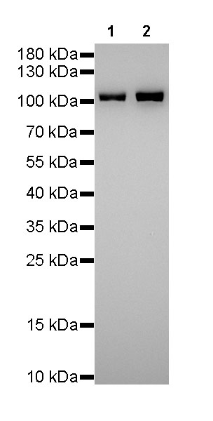 α-Actinin-1 Recombinant Rabbit mAb (SDT-311-20)