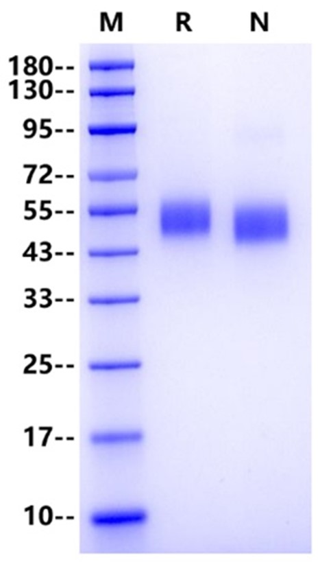 H1N1 HA1 (A/Brevig Mission/1/1918) His Tag Protein