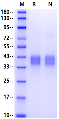 Carbonic Anhydrase XII His Tag Protein, Human