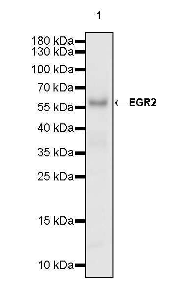 EGR2 Recombinant Rabbit mAb (S-741-136)