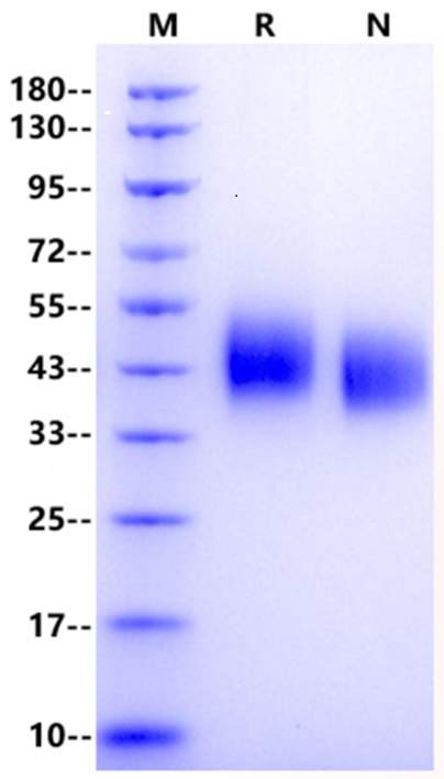 SLAMF1/SLAM/CD150 His Tag Protein, Mouse