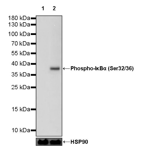 Phospho-IκBα (Ser32/36) Recombinant Rabbit mAb (S-751-40)