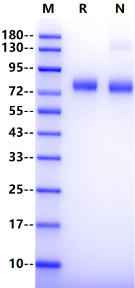 IL-12 R beta 1 His Tag Protein, Human