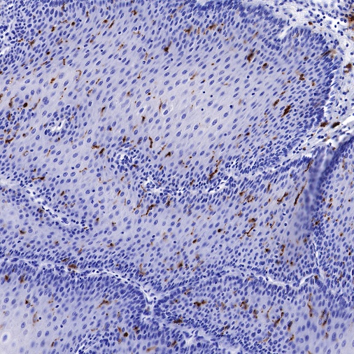 Langerin Recombinant Rabbit mAb (SDT-450-47)