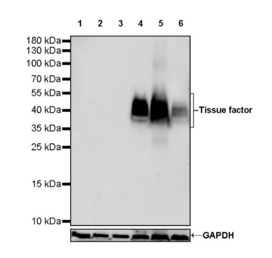 Tissue factor Recombinant Rabbit mAb (S-893-34)