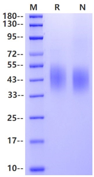2B4/CD244 His Tag Protein, Human