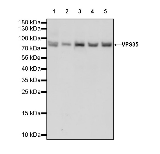 VPS35 Recombinant Rabbit mAb (S-997-2)