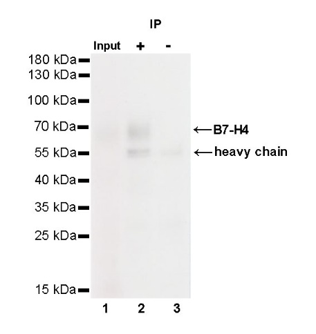 B7-H4 Recombinant Rabbit mAb (SDT-314-447-2)