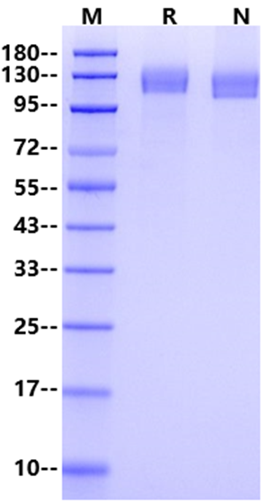 OSMR/IL-31RB His Tag Protein, Mouse