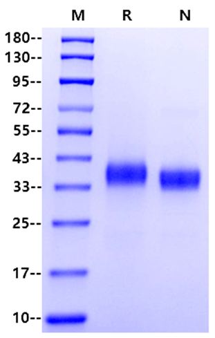 Spike RBD His Tag, SARS-CoV-2(B.1.1.529/Omicron, N terminal)