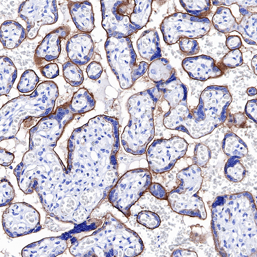 CD39 Recombinant Rabbit mAb (SDT-236-20)