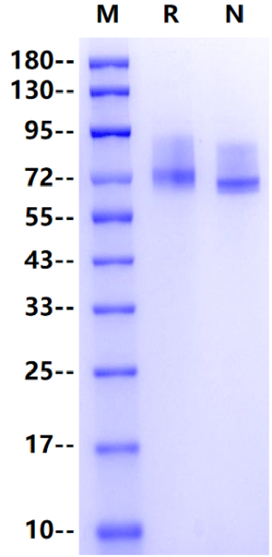 EphA10 His Tag Protein, Human