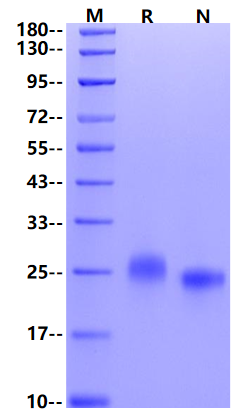 CLECSF6/DCIR/CLEC4A His Tag Protein, Human