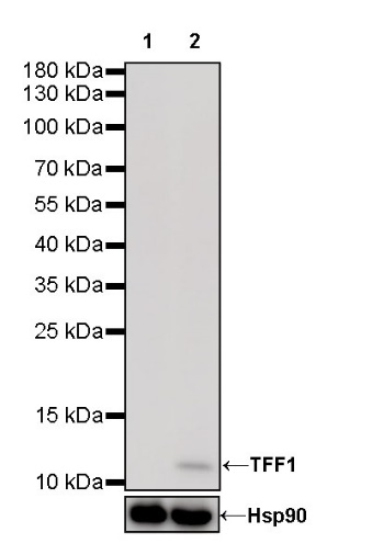 TFF1 Recombinant Rabbit mAb (S-336-75)