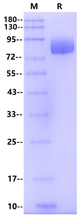 Siglec-6/CD327 Fc Chimera Protein, Human