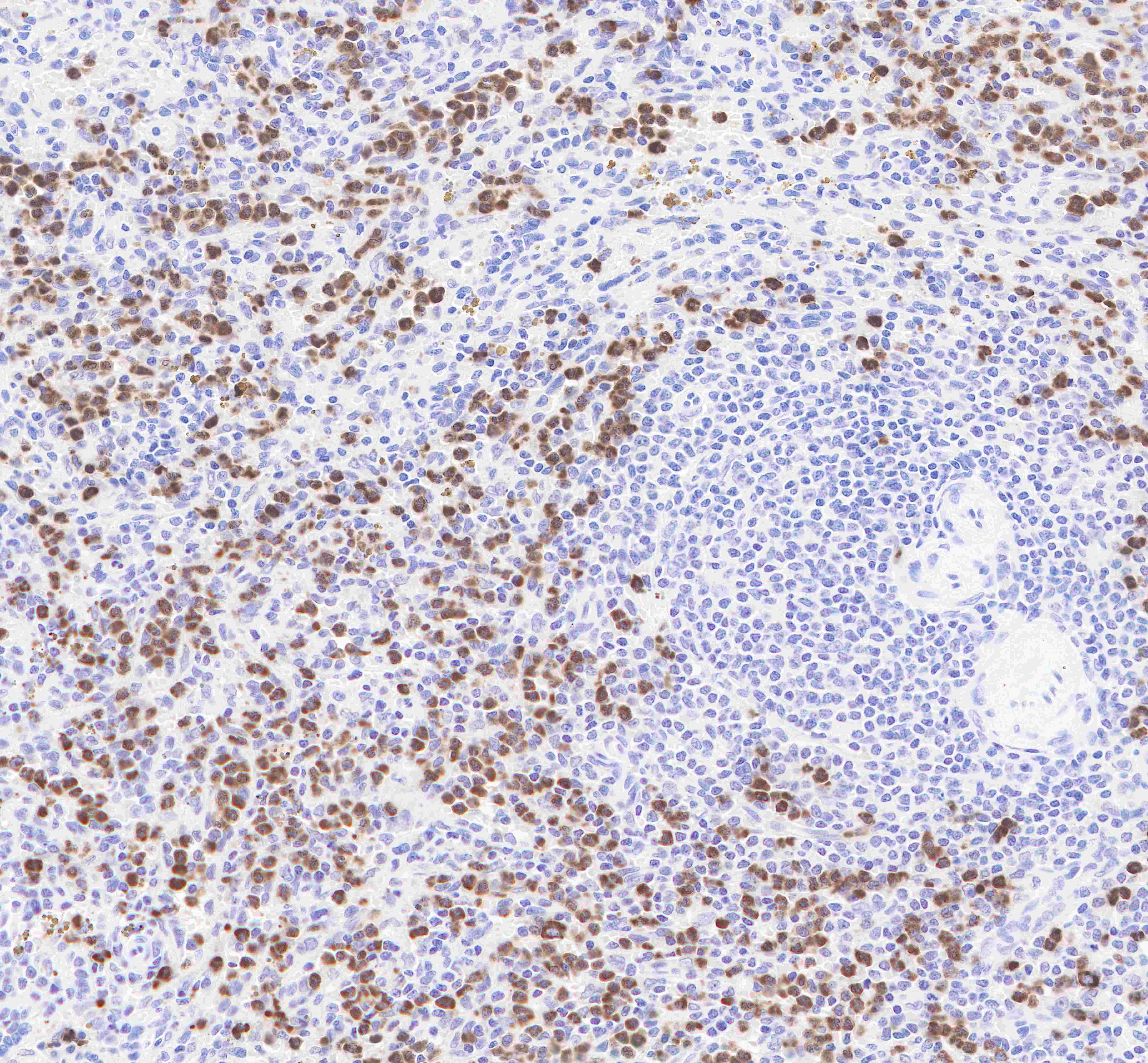 Myeloperoxidase Recombinant Rabbit mAb(SDT-041-18)