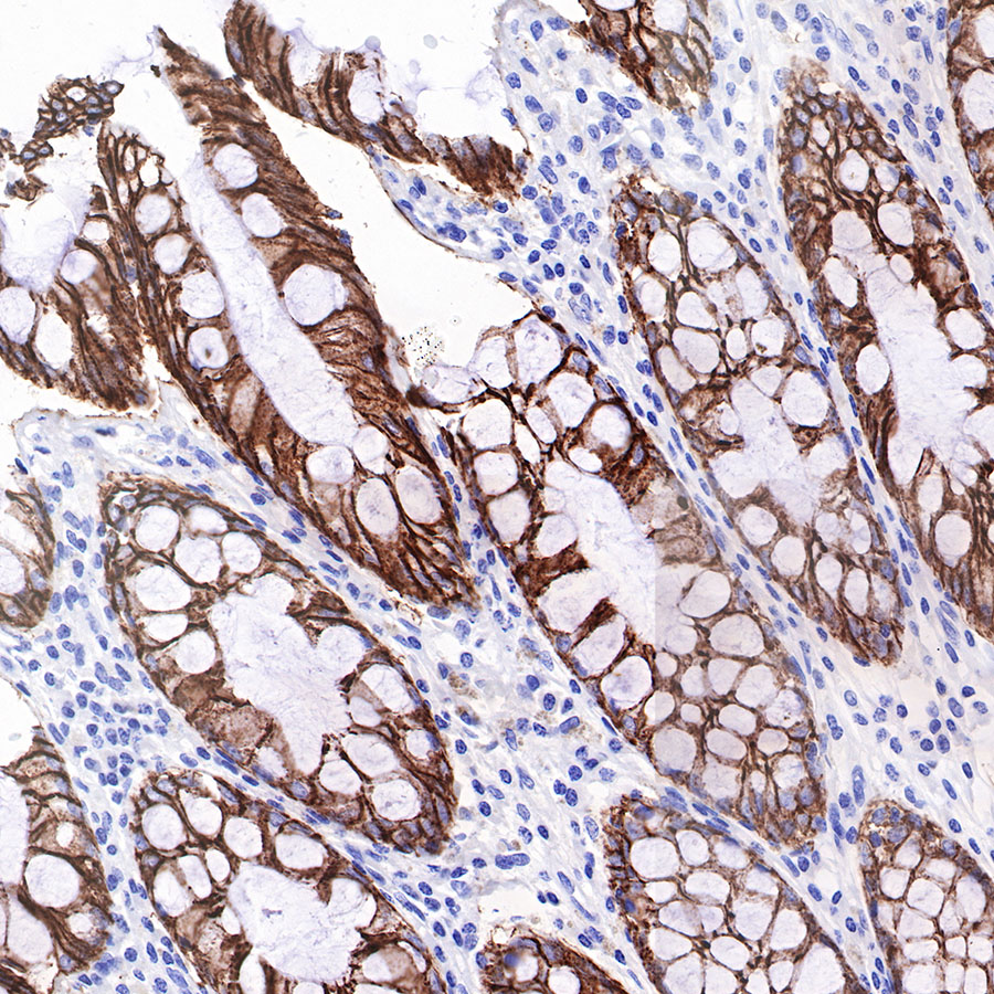 Cadherin 17 Recombinant Rabbit mAb (SDT-R151)