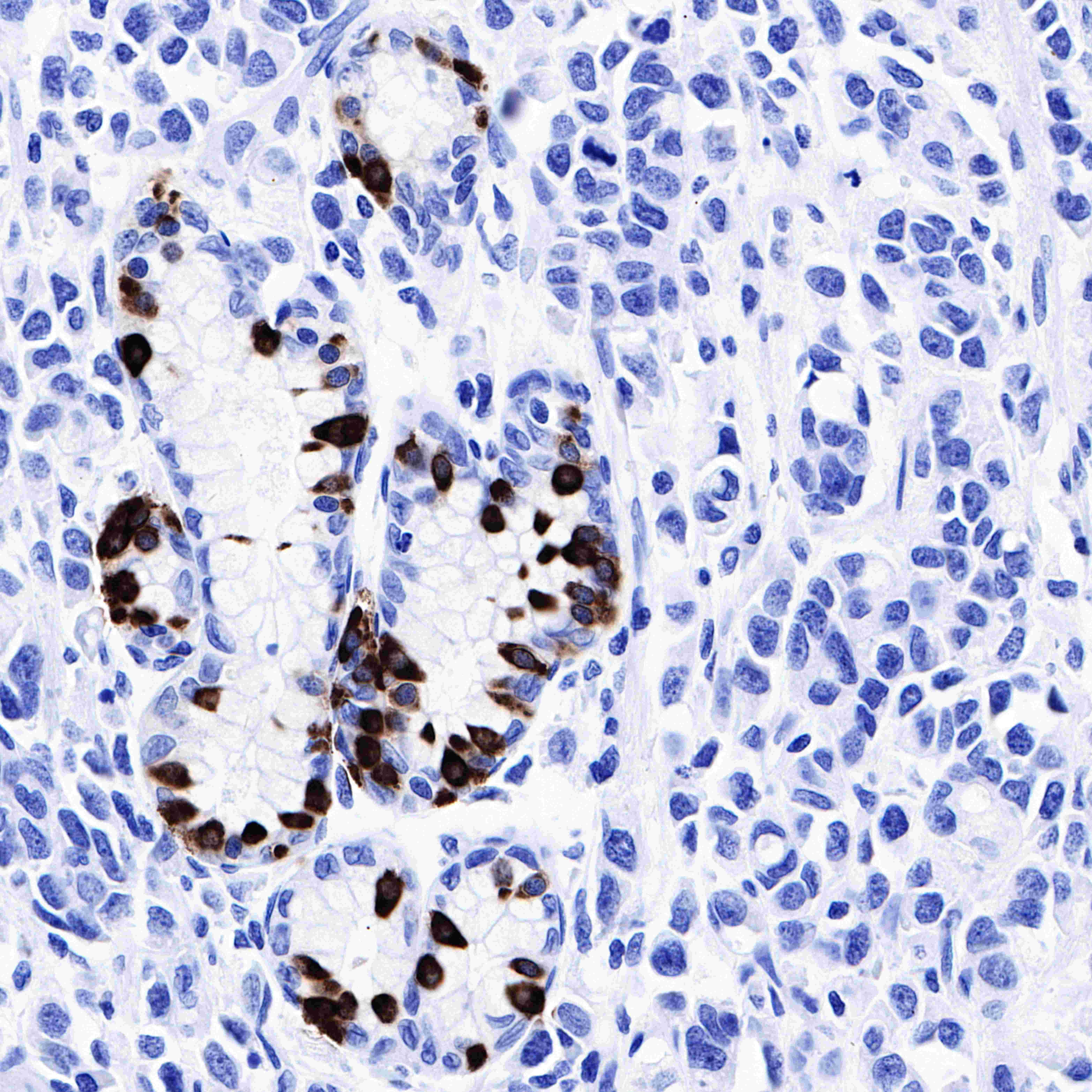 Gastrin Recombinant Rabbit mAb (SDT-R068)