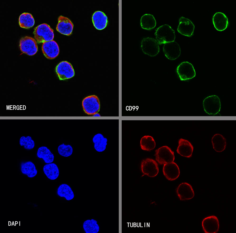 CD99 Recombinant Rabbit mAb (SDT-R122)