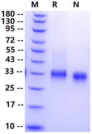Biotinylated Fc γ RIIA/CD32a(R167) His&Avi Tag Protein, Human