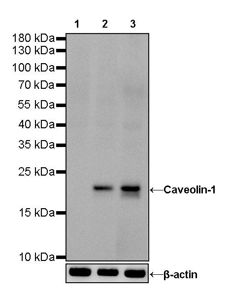 Caveolin-1 Recombinant Rabbit mAb (HRP Conjugate) (SDT-065-20)