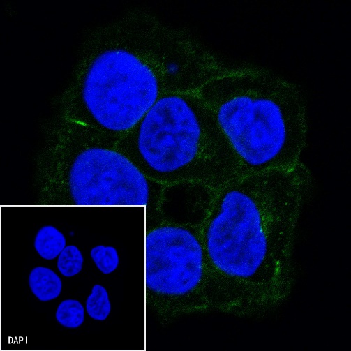 E-Cadherin Recombinant Rabbit mAb (FITC Conjugate) (S-438-5)