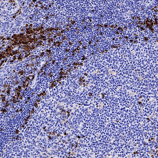 CXCR3 Recombinant Rabbit mAb (S-377-8)
