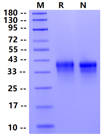 Biotinylated FOLR1 His&Avi Tag Protein, Human