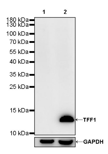 TFF1 Recombinant Rabbit mAb (S-481-16)