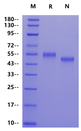 ROR2 His Tag Protein, Human