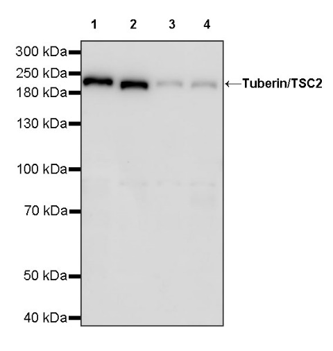 Tuberin/TSC2 Recombinant Rabbit mAb (S-1138-125)