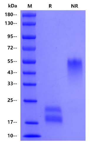 Human CGA&TSHB protein, No tag&His tag