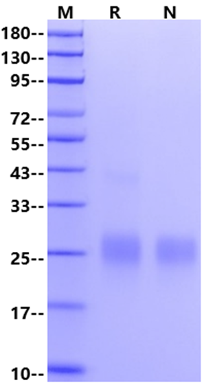 ALK-1/ACVRL1 His Tag Protein, Human