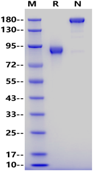 DDR1 Fc Chimera Protein, Human