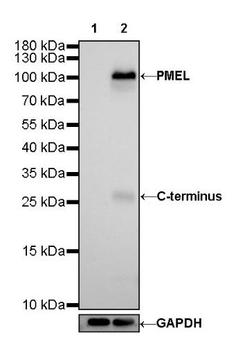 PMEL/Melanoma gp100 Recombinant Rabbit mAb (SDT-434-70)