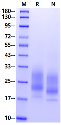 CD83 His Tag Protein, Human